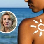 Dermatolog upozorava: Ljetno sunce može ostaviti trajne posljedice na koži