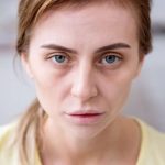 Nedostaje li vam željeza? Ovi znakovi na licu to otkrivaju